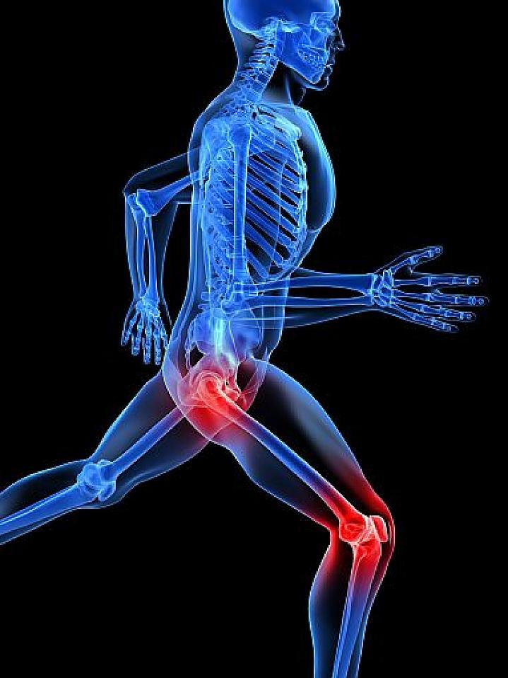 Ilustración de un esqueleto humano con las articulaciones de la cadera y la rodilla resaltadas en rojo. 