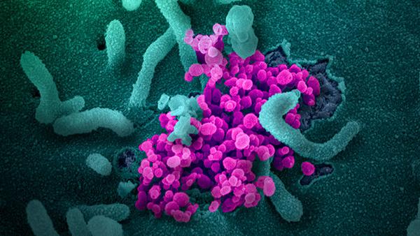 Una imagen de microscopio electrónico de barrido de SARS-CoV-2.