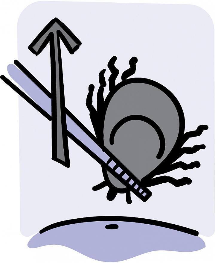 Ilustración de una garrapata agarrada por pinzas y levantada de la piel.