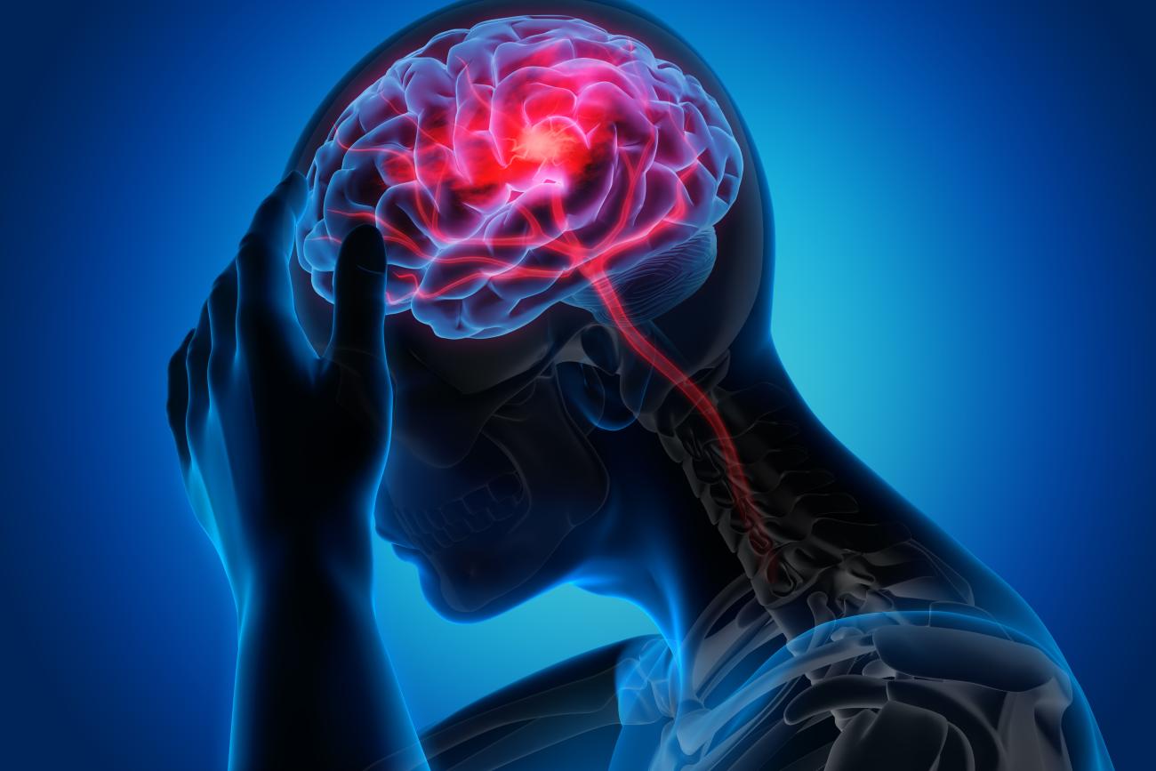 Ilustración de una persona sosteniéndose la cabeza, en cuyo interior se ve el cerebro
