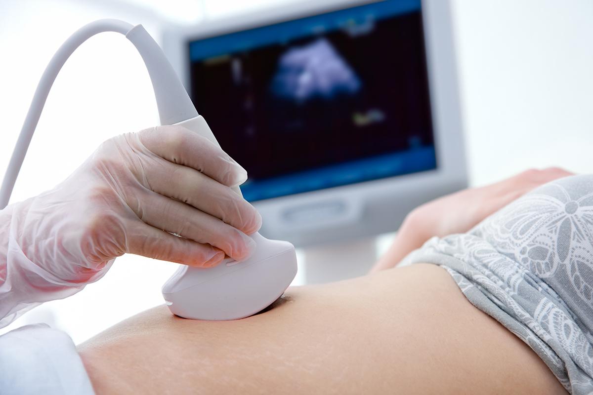 Una fotografía muestra a una mujer recibiendo un examen de ultrasonido en su abdomen.