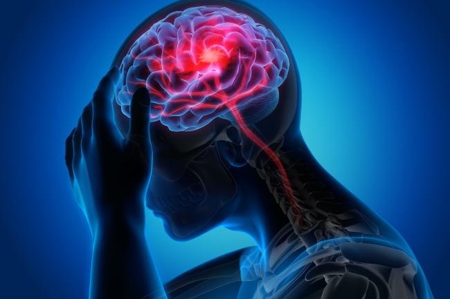 Ilustración de una persona sosteniéndose la cabeza, en cuyo interior se ve el cerebro