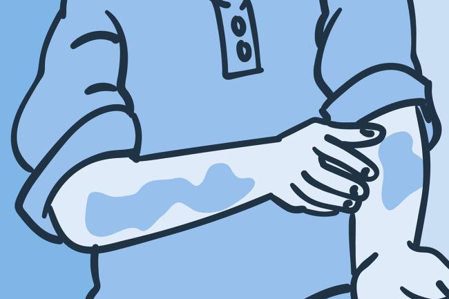 Ilustración de un hombre tocando unas irritaciones en sus brazos.