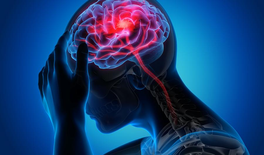 Ilustración de una persona sosteniéndose la cabeza, en cuyo interior se ve el cerebro