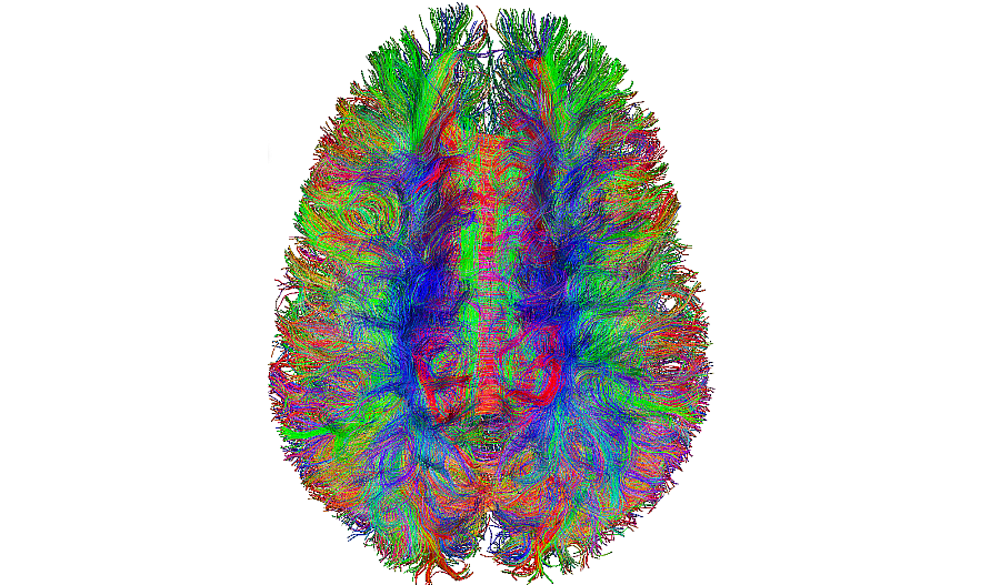 Imagen de un escáner cerebral